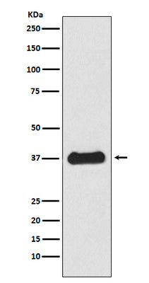 Anti-Follistatin Rabbit Monoclonal Antibody Boster Bio