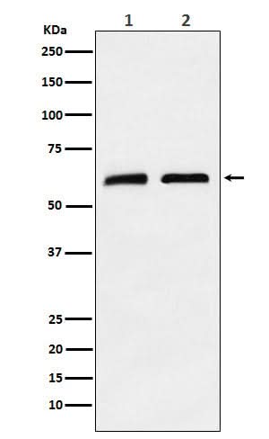 Anti-CLPX Rabbit Monoclonal Antibody Boster Bio