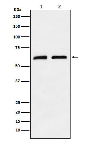 Anti-CLPX Rabbit Monoclonal Antibody Boster Bio
