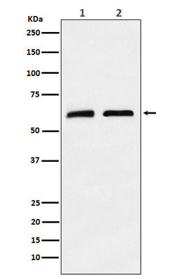 Anti-CLPX Rabbit Monoclonal Antibody Boster Bio