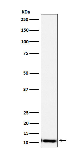 Anti-SPINK1 Rabbit Monoclonal Antibody Boster Bio