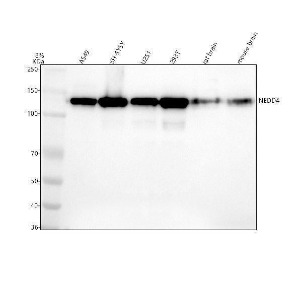 Anti-NEDD4 Rabbit Monoclonal Antibody Boster Bio
