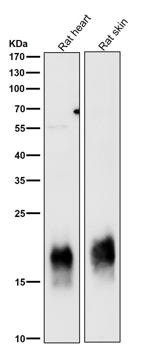 Anti-Caveolin-3 CAV3 Rabbit Monoclonal Antibody Boster Bio