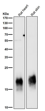Anti-Caveolin-3 CAV3 Rabbit Monoclonal Antibody Boster Bio