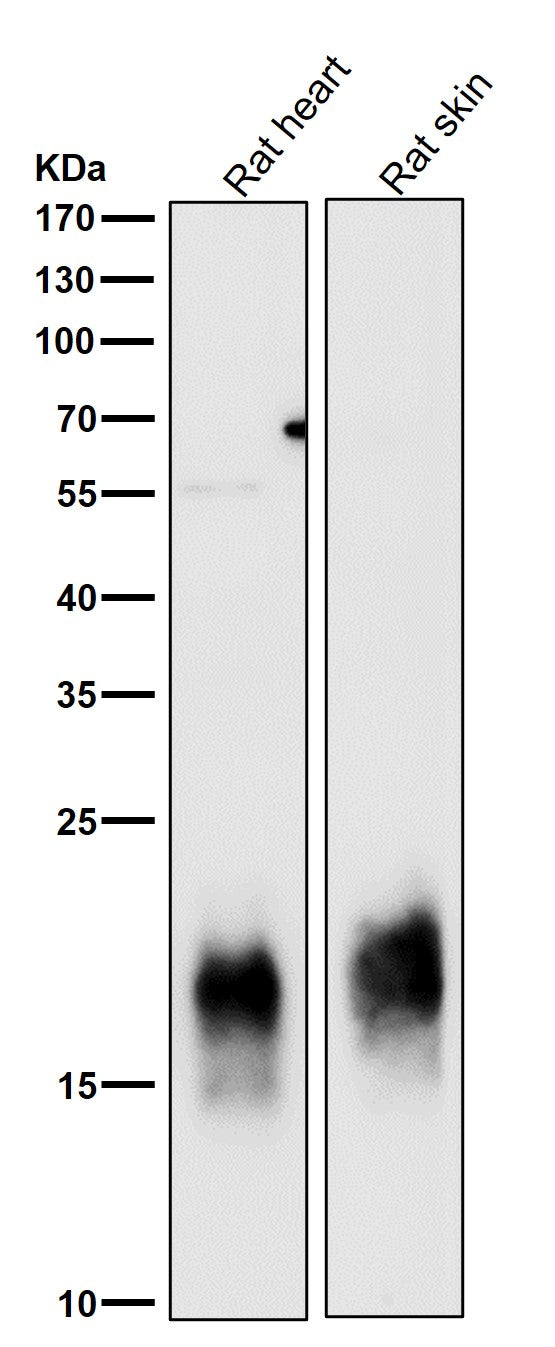 Anti-Caveolin-3 CAV3 Rabbit Monoclonal Antibody Boster Bio