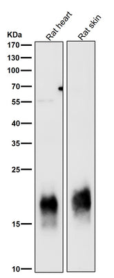 Anti-Caveolin-3 CAV3 Rabbit Monoclonal Antibody Boster Bio
