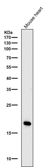 Anti-Caveolin-3 Rabbit Monoclonal Antibody Boster Bio
