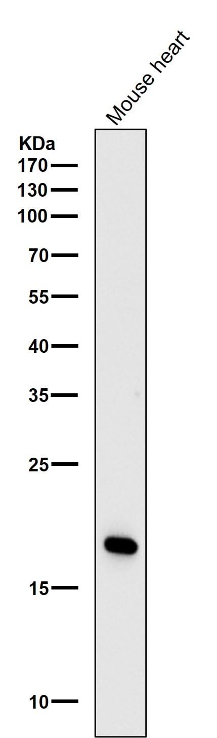 Anti-Caveolin-3 Rabbit Monoclonal Antibody Boster Bio