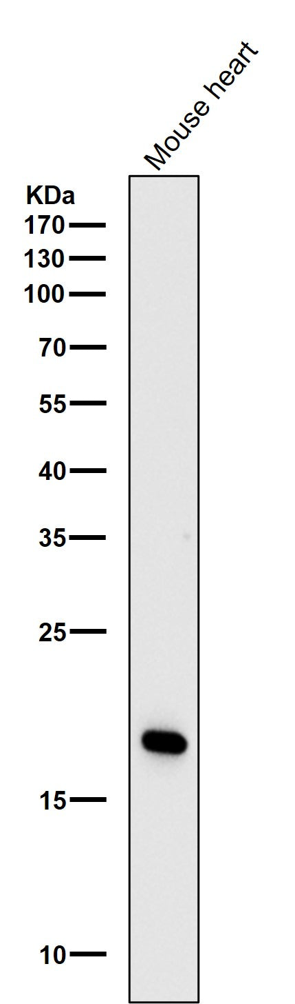 Anti-Caveolin-3 Rabbit Monoclonal Antibody Boster Bio