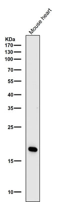 Anti-Caveolin-3 Rabbit Monoclonal Antibody Boster Bio