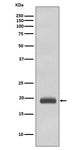 Anti-Caveolin-3 CAV3 Rabbit Monoclonal Antibody Boster Bio