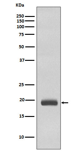 Anti-Caveolin-3 CAV3 Rabbit Monoclonal Antibody Boster Bio