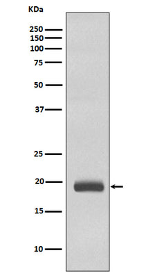 Anti-Caveolin-3 CAV3 Rabbit Monoclonal Antibody Boster Bio