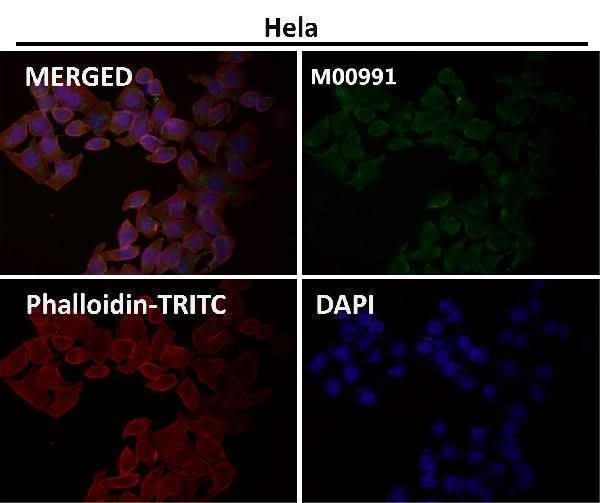 Anti-Syndecan 1 SDC1 Rabbit Monoclonal Antibody Boster Bio