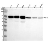 Anti-AMPK alpha 1 PRKAA1 Rabbit Monoclonal Antibody Boster Bio