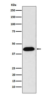Anti-NUDC Rabbit Monoclonal Antibody Boster Bio