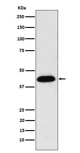 Anti-NUDC Rabbit Monoclonal Antibody Boster Bio