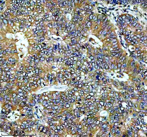 Anti-MEK2 MAP2K2 Rabbit Monoclonal Antibody Boster Bio