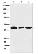 Anti-TDP43 Rabbit Monoclonal Antibody Boster Bio