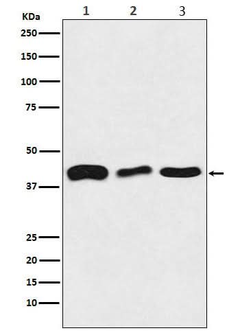 Anti-TDP43 Rabbit Monoclonal Antibody Boster Bio
