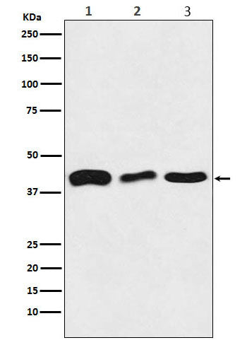 Anti-TDP43 Rabbit Monoclonal Antibody Boster Bio