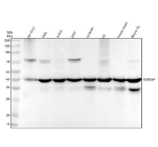 Anti-TDP43 TARDBP Rabbit Monoclonal Antibody Boster Bio