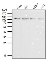 Anti-TRPM8 Monoclonal Antibody Boster Bio