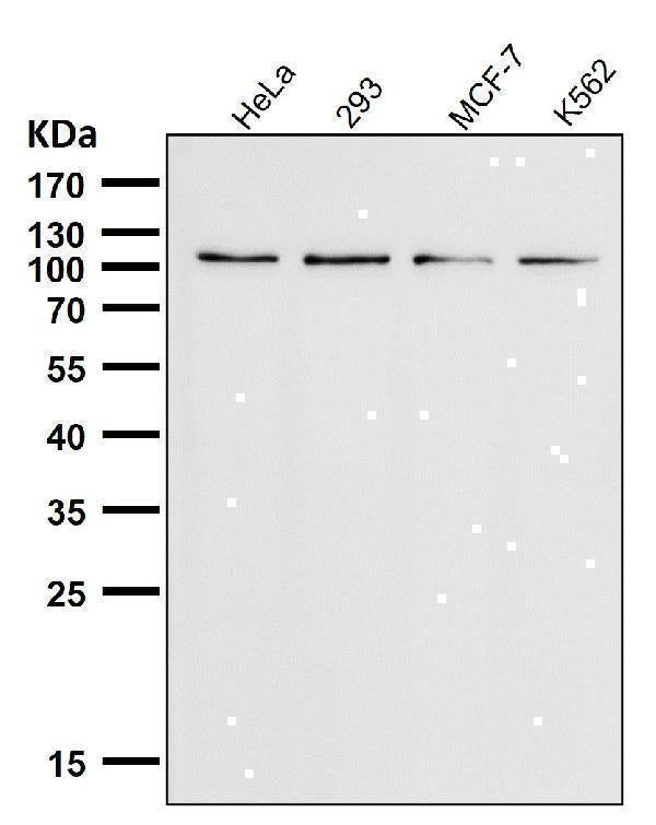 Anti-TRPM8 Monoclonal Antibody Boster Bio