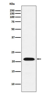 Anti-CBFb Rabbit Monoclonal Antibody Boster Bio