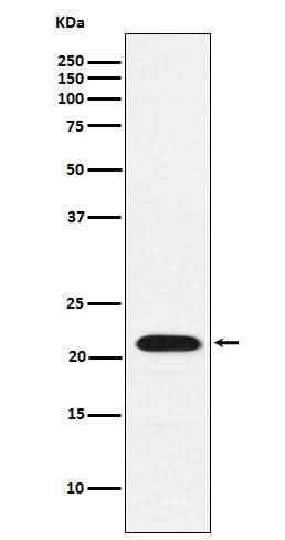 Anti-CBFb Rabbit Monoclonal Antibody Boster Bio