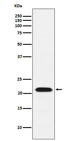 Anti-CBFb Rabbit Monoclonal Antibody Boster Bio