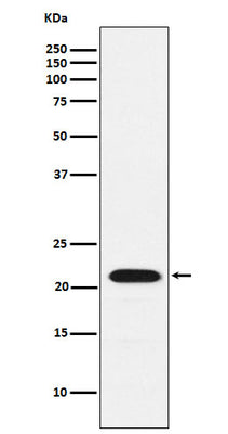 Anti-CBFb Rabbit Monoclonal Antibody Boster Bio