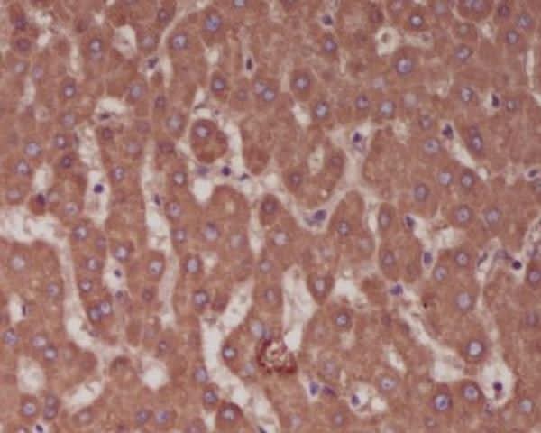 Anti-Alkaline Phosphatase ALPL Rabbit Monoclonal Antibody Boster Bio