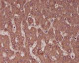 Anti-Alkaline Phosphatase ALPL Rabbit Monoclonal Antibody Boster Bio