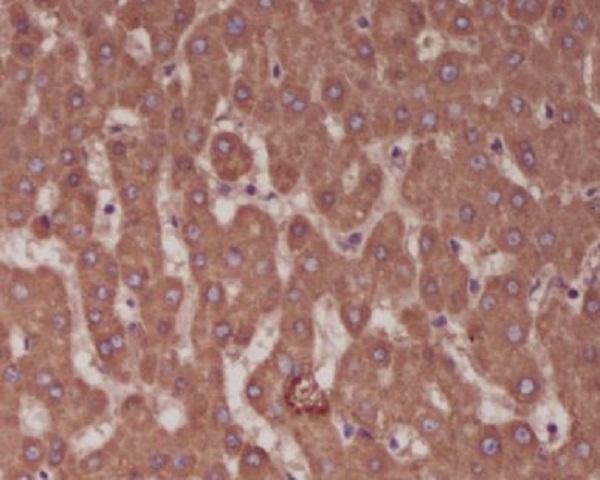 Anti-Alkaline Phosphatase ALPL Rabbit Monoclonal Antibody Boster Bio