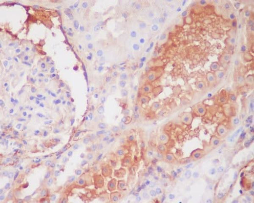 Anti-C9/Complement Component C9 Rabbit Monoclonal Antibody Boster Bio