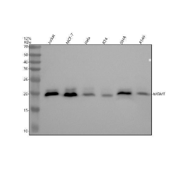 Anti-MGMT Rabbit Monoclonal Antibody Boster Bio