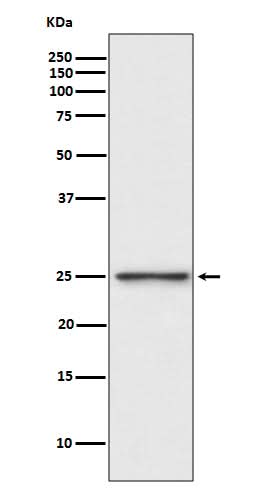Anti-PGP9.5 Rabbit Monoclonal Antibody Boster Bio