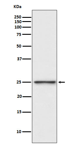 Anti-PGP9.5 Rabbit Monoclonal Antibody Boster Bio