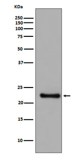 Anti-GPX1/Glutathione Peroxidase 1 Rabbit Monoclonal Antibody Boster Bio