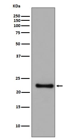 Anti-GPX1/Glutathione Peroxidase 1 Rabbit Monoclonal Antibody Boster Bio