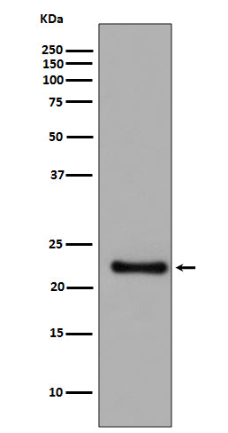Anti-GPX1/Glutathione Peroxidase 1 Rabbit Monoclonal Antibody Boster Bio