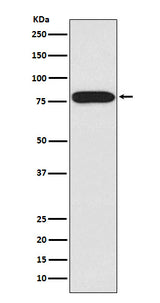 Anti-IRAK IRAK1 Monoclonal Antibody Boster Bio