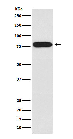 Anti-IRAK IRAK1 Monoclonal Antibody Boster Bio