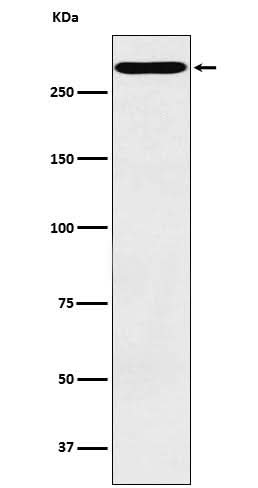 Anti-CD35 Rabbit Monoclonal Antibody Boster Bio