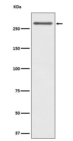 Anti-CD35 Rabbit Monoclonal Antibody Boster Bio