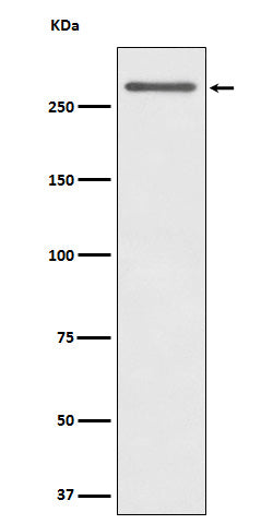 Anti-CD35 Rabbit Monoclonal Antibody Boster Bio
