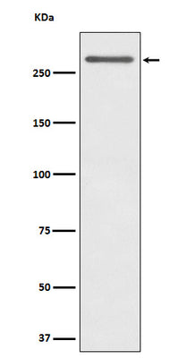 Anti-CD35 Rabbit Monoclonal Antibody Boster Bio