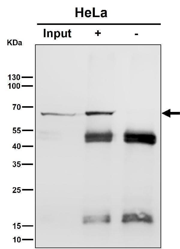 Anti-Hsp70 Rabbit Monoclonal Antibody Boster Bio