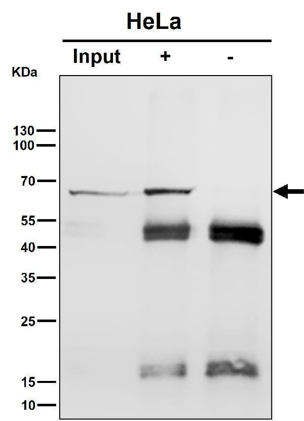 Anti-Hsp70 Rabbit Monoclonal Antibody Boster Bio